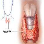 علائم پرکاری تیروئید چیست؟