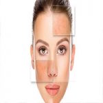 نشانه های پوست چرب چیست؟